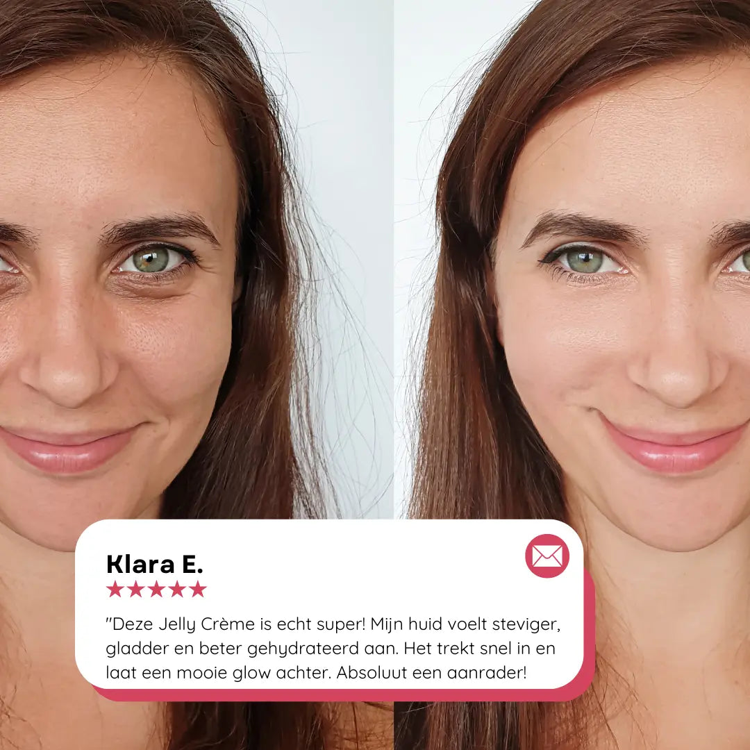 Voor en na resultaat met collageen jelly crème – egalere teint en verbeterde huidelasticiteit.
